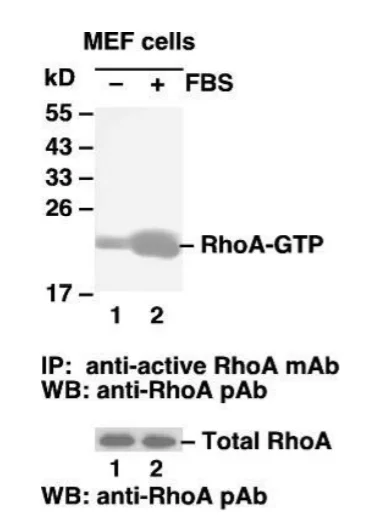 RhoA Activation Assay Kit